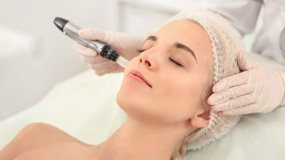 dermapen microneedling